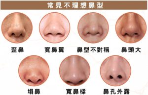 鼻子 9 01 e1791274991637
