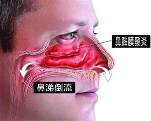 鼻子 6 e1791274979791