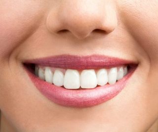 牙齒 9 TeethWhitening slide1 1024 768x512 1 e1791785373524