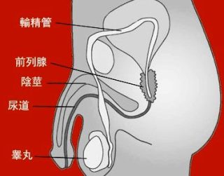 desktop Prostate Cancer chi e1793085239310
