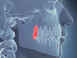 牙齒 2 wisdom teeth third molar w e1791786758162